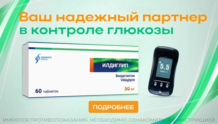 Илдиглип