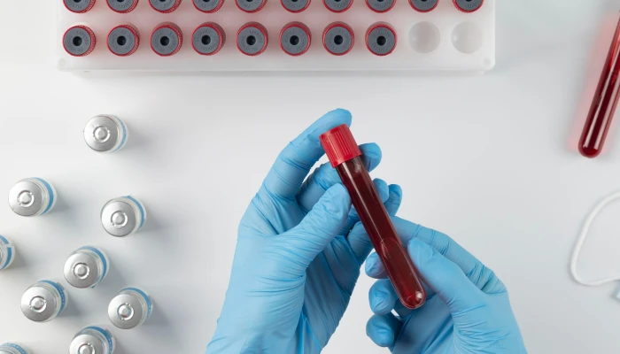 Что входит в биохимический анализ крови