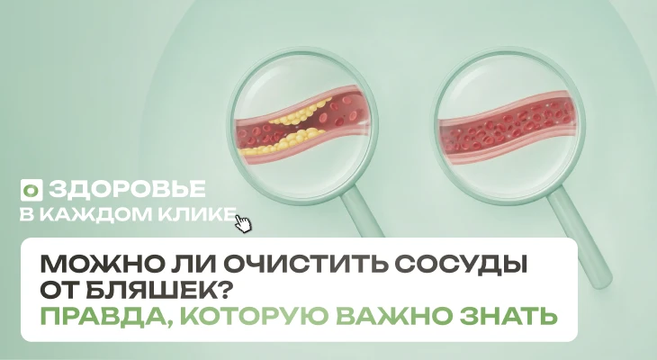 Как почистить сосуды от холестериновых бляшек
